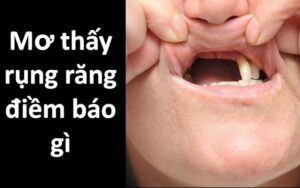 Mơ thấy rụng răng đánh con gì & 9 điềm báo về giấc mơ