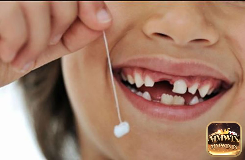 Giải mã giấc mơ thấy mình tự nhổ răng mang đến cho bạn nhiều con số may mắn mỗi ngày